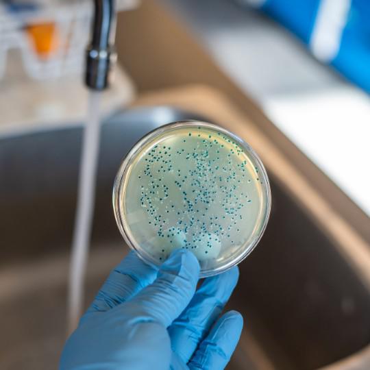 Analise microbiologica da agua potavel